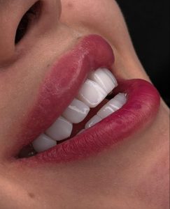 کلینیک لبخند سپید دندانپزشکی در تهران نارمک