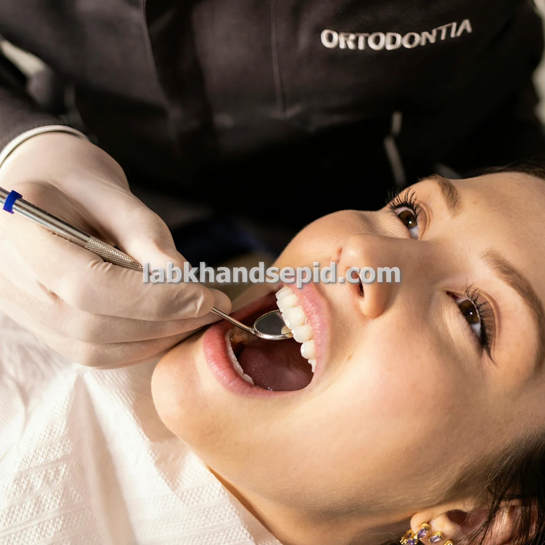 خدمات کامپوزیت و لمینت و ایمپلنت دندان حرفه ای در شرق تهران